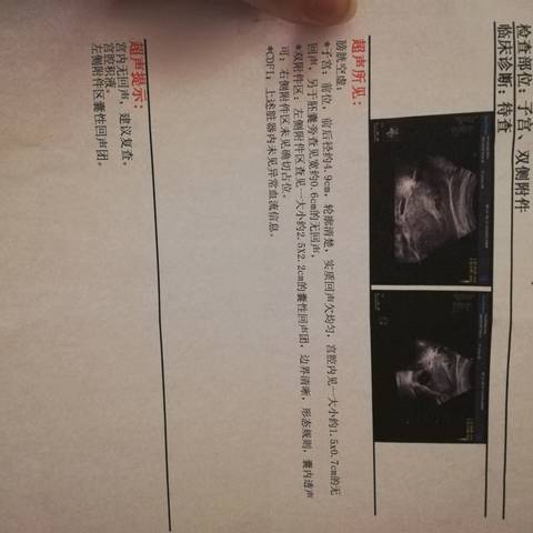 孕4周左右,今天检查b超未见卵黄囊胚芽,医生说发育不好,怎么办