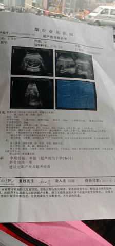 journal_insert_pic_1552206620