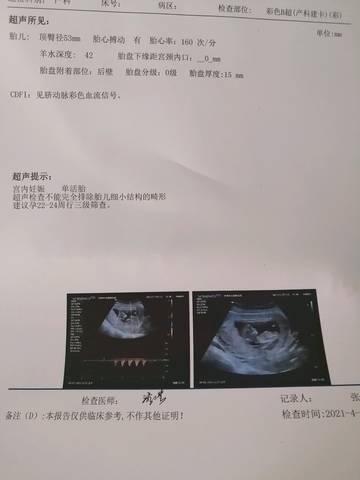 journal_insert_pic_1561005549