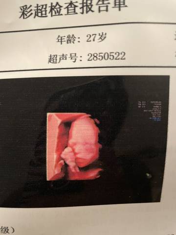 journal_insert_pic_1580468223