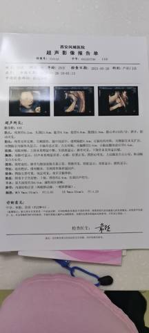 journal_insert_pic_1583422556
