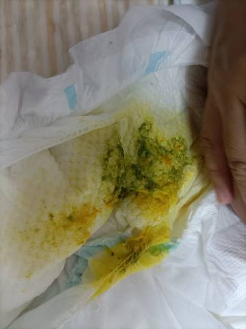 42天母乳喂养宝宝拉绿色大便是什么原因?