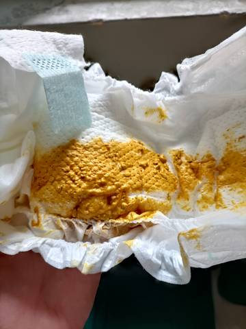 怀孕周!新生儿一天几次大便正常"美好愿景"-第2张图片-途临网