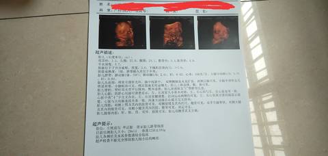 journal_insert_pic_1605266954