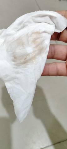 怀孕50天左右 小便有这个 这算褐色分泌物吗 怎么办啊