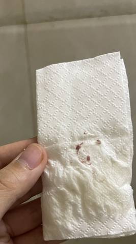 小便后擦出来的,以前没有过
