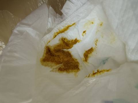 这样的便便是正常的嘛