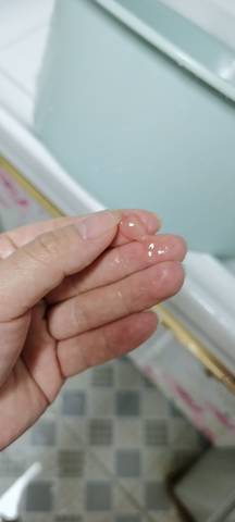 36周2这个是不是果冻分泌物
