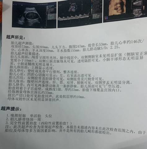 journal_insert_pic_1645275771