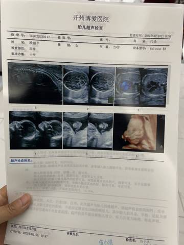 journal_insert_pic_1732427715
