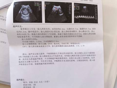 journal_insert_pic_1877901550