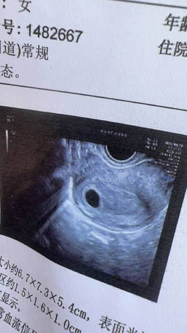 journal_insert_pic_4108796499