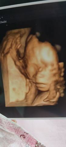 journal_insert_pic_4117415246