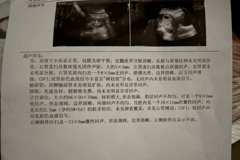 journal_insert_pic_4412343750