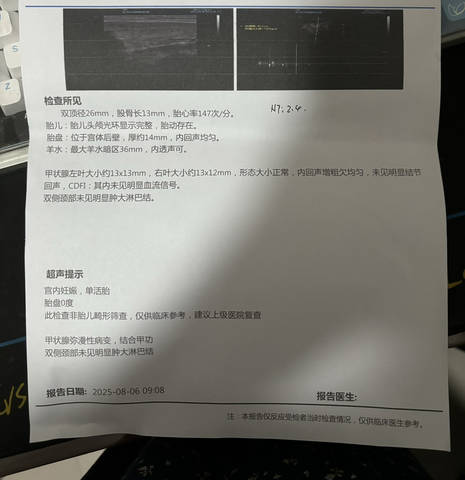 journal_insert_pic_4412577353