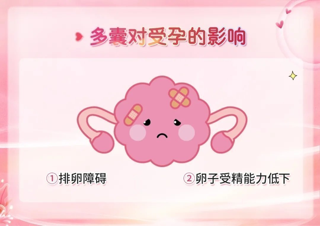 多囊对怀孕有严重影响  确实是！多囊是一种复杂的内分泌代谢疾病，会直接导致体内激素水平出现异常，就由此导致小卵泡成熟障碍、卵子受精能力低下，甚至引起卵泡闭锁不排卵等情况。 多囊女性内