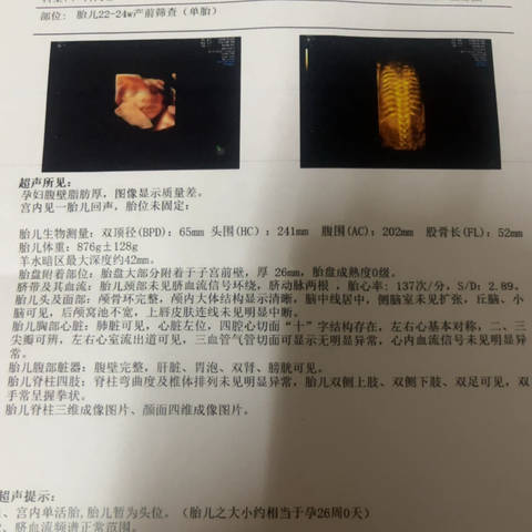 大家帮我看看是女宝还是男宝