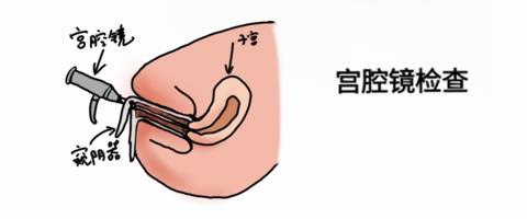 journal_insert_pic_1006761559