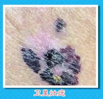 journal_insert_pic_898226458