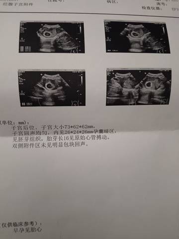 journal_insert_pic_4412338538